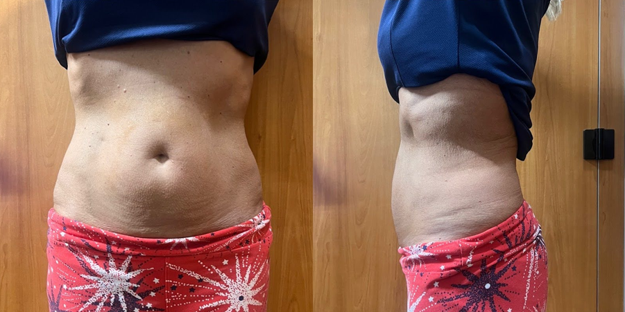 muscle sculpt before and after